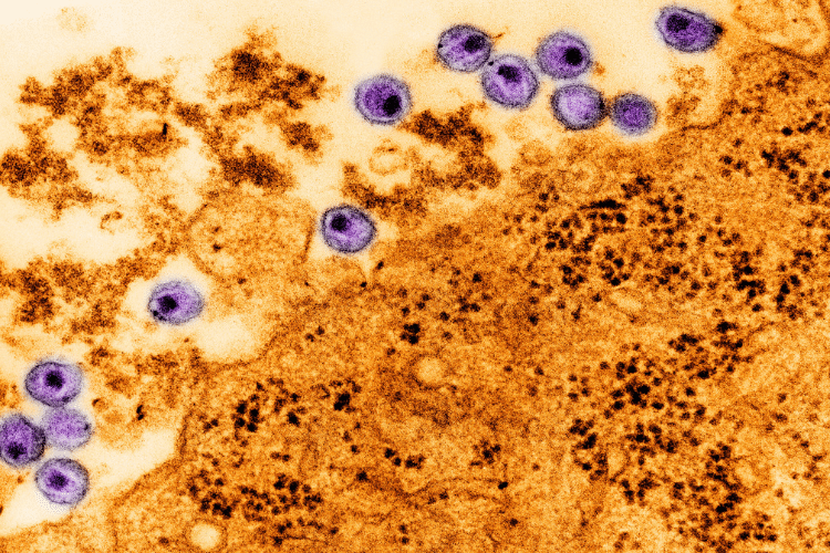 Virus electron micrograph